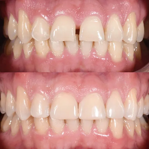Rehabilitación Oral Completa